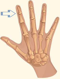 Distal Interphalangeal Joint
