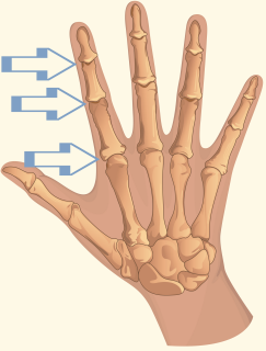 Interphalangeal Joints