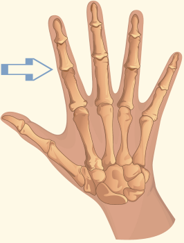 Proximal Interphalangeal Joint Revealing Paws
