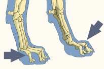 Proximal Interphalangeal Joints